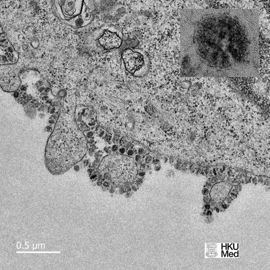 香港大学在推特发布的新冠病毒图像。