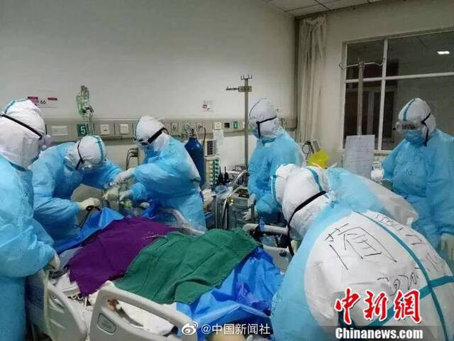 16小时手动生命接力 他们成功抢救一名危重症患者