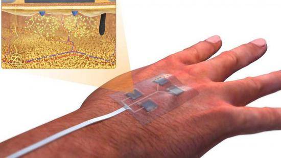 研究人员设计出用于治愈伤口的新型无线智能绷带
