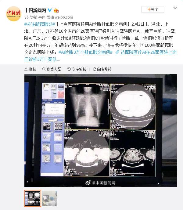 上百家医院将用AI诊断疑似肺炎病例
