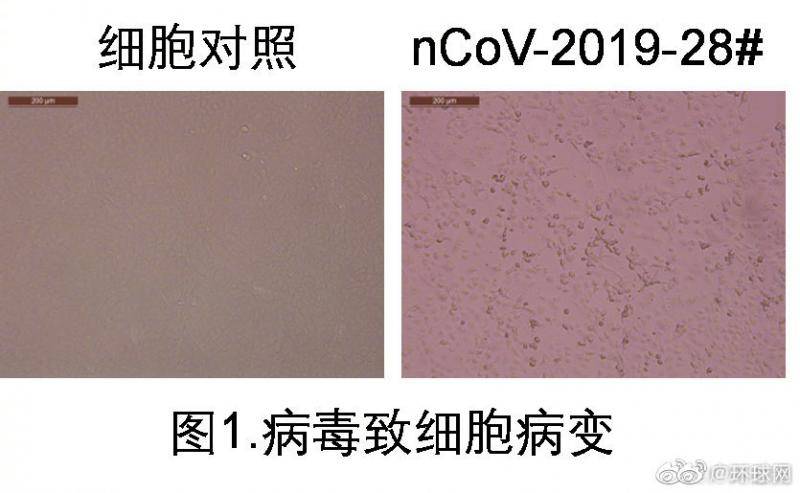 钟南山团队回应尿液中分离病毒 要更加重视个人和家庭的清洁！