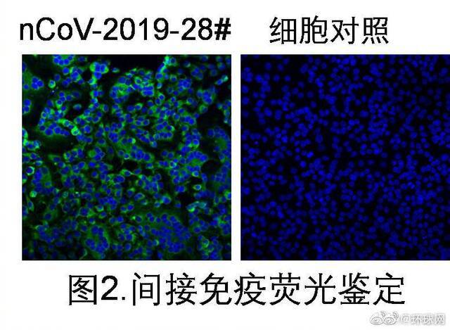 钟南山团队回应尿液中分离病毒 要更加重视个人和家庭的清洁！