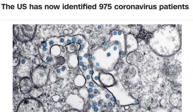 美国新冠肺炎确诊病例升至975例 31人死亡