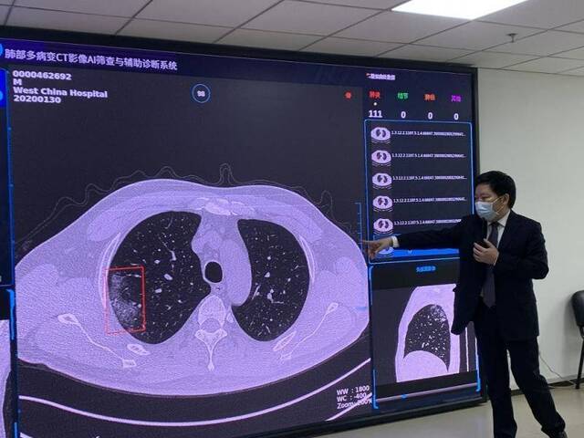 秒级筛查新冠肺炎！肺部多病变AI筛查系统供医疗机构免费研究性使用