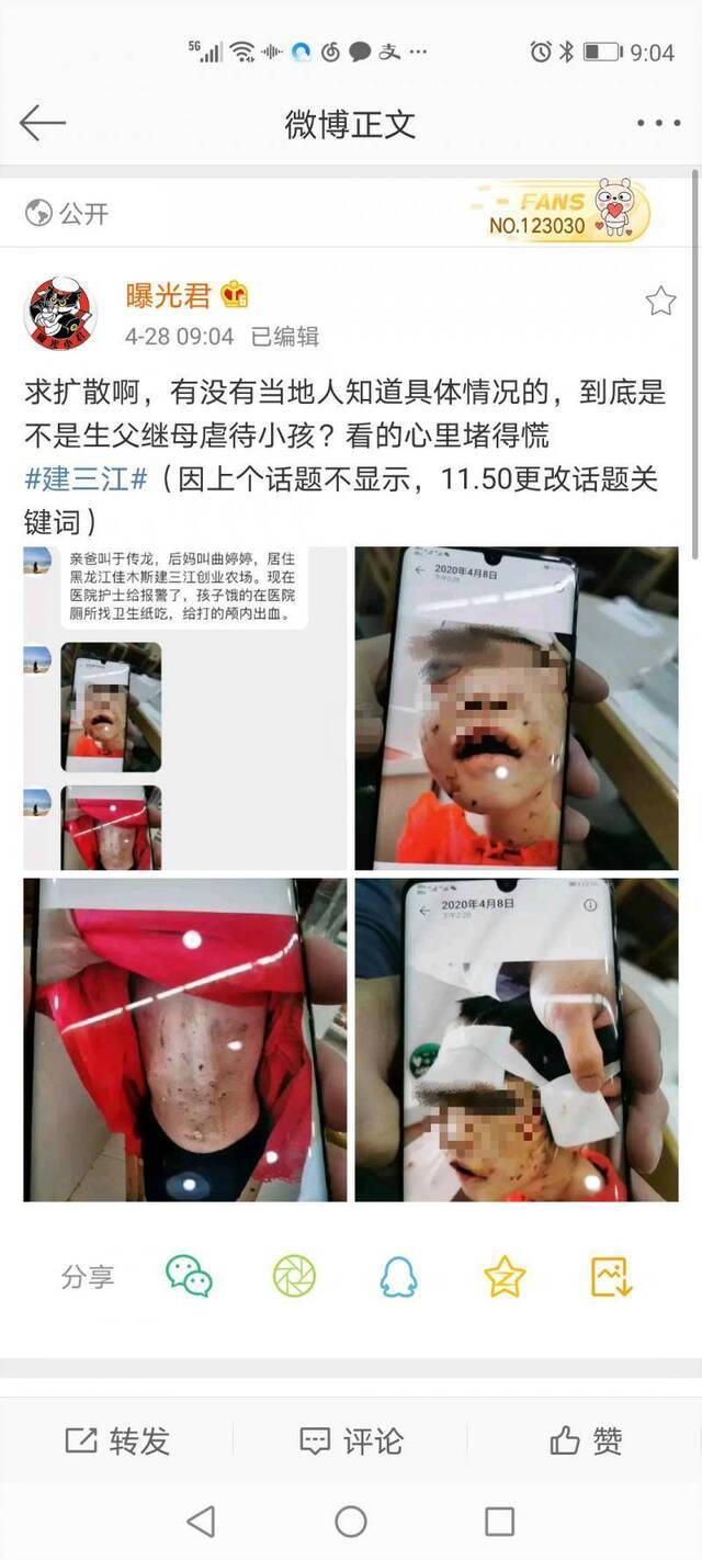 有微博网友曝光，建三江创业农场有4岁女童被虐打。@“曝光君”微博图