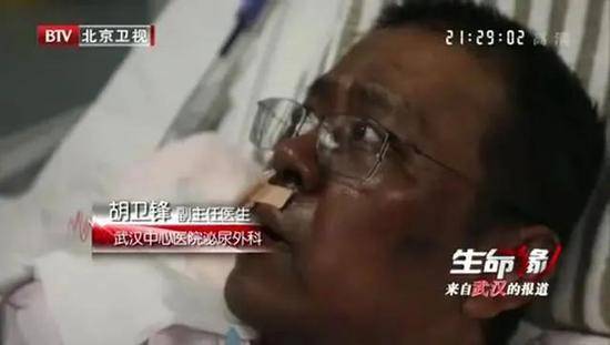 武汉医生感染被救后先变黑，再出血！新冠病毒没你想那样简单！