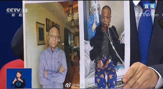 武汉中心医院易凡医生皮肤已变白