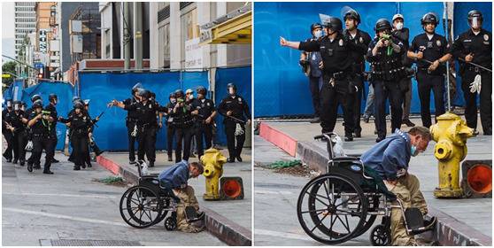 触目惊心！美国流浪汉遭警方橡皮子弹击中满脸是血