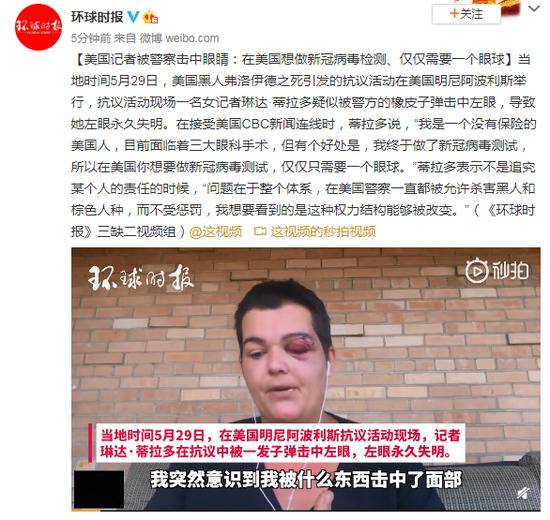 美国记者疑似被警察击中眼睛：在美国想做新冠病毒检测，仅仅需要一个眼球