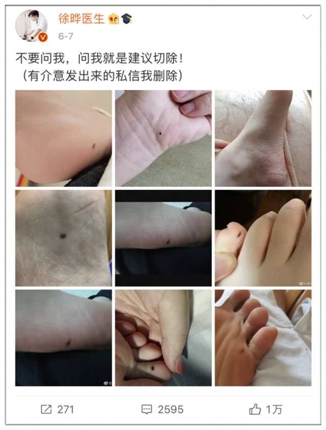 这个病太可怕！知名医生提醒，全国网友都在看脚底板