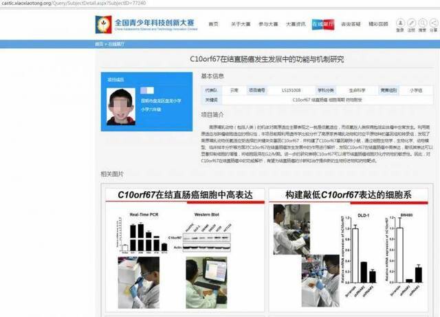 ↑云南昆明小学生陈某某“C10orf67在结直肠癌发生发展中的功能与机制研究”研究获奖。全国青少年科技创新大赛官网图