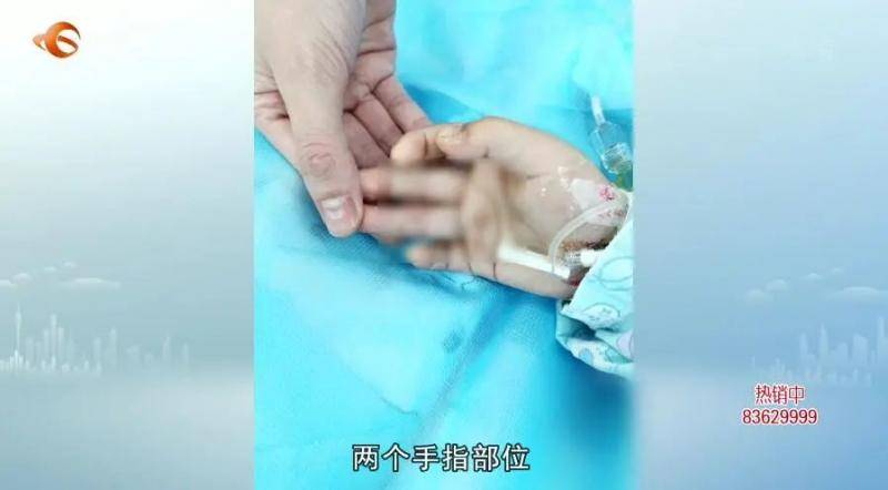 惊悚！东莞两岁女童用金属筷子戳插座，触电晕厥…