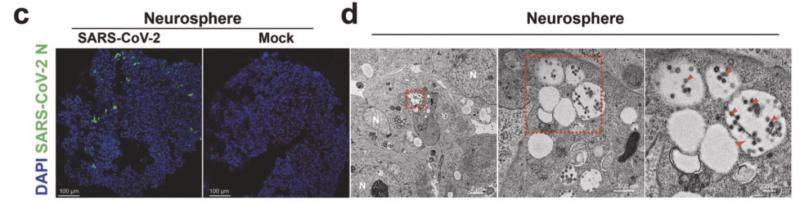 港大等团队首次证明新冠直接感染人中枢系统，应监测长期后果