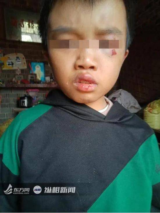 江西12岁男童满身伤痕惨死家中爷爷：一定是被打的