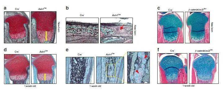 新闻｜王拥军、陈棣联合团队在《Bone Research》发表骨发育调控机制的研究成果