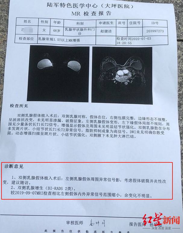 陆军军医大学第一附属医院检查报告