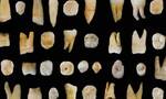 美国科学家利用牙齿来判定古人类遗骸性别