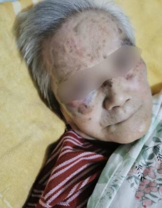 老人受伤的面部。朝阳区人民法院供图