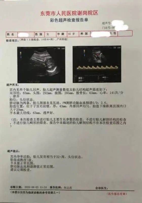 心大！女子以为发胖，一查已怀孕8个月​