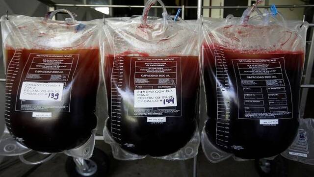 哥斯达黎加科研人员从马匹体内获得的血清抗体（图源：路透社）