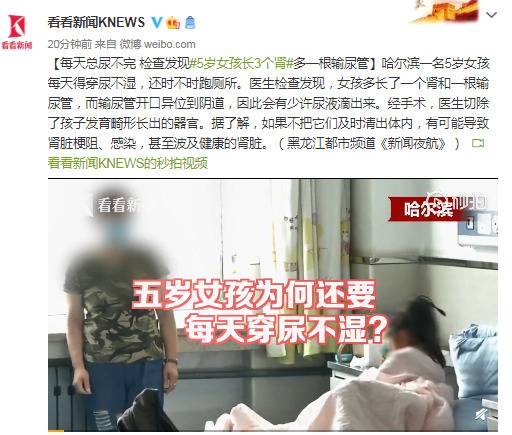 每天总尿不完 检查发现5岁女孩长3个肾多一根输尿管