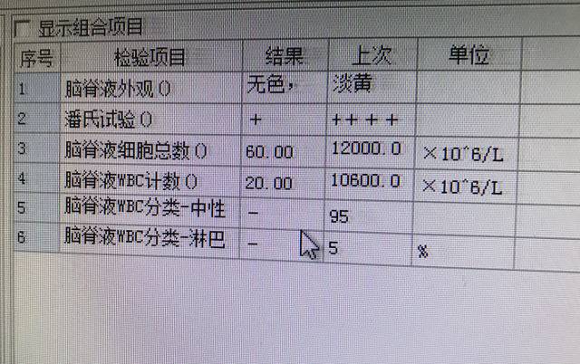 ▲经检测，闭女士脑脊液和血培养细菌鉴定确为猪链球菌。