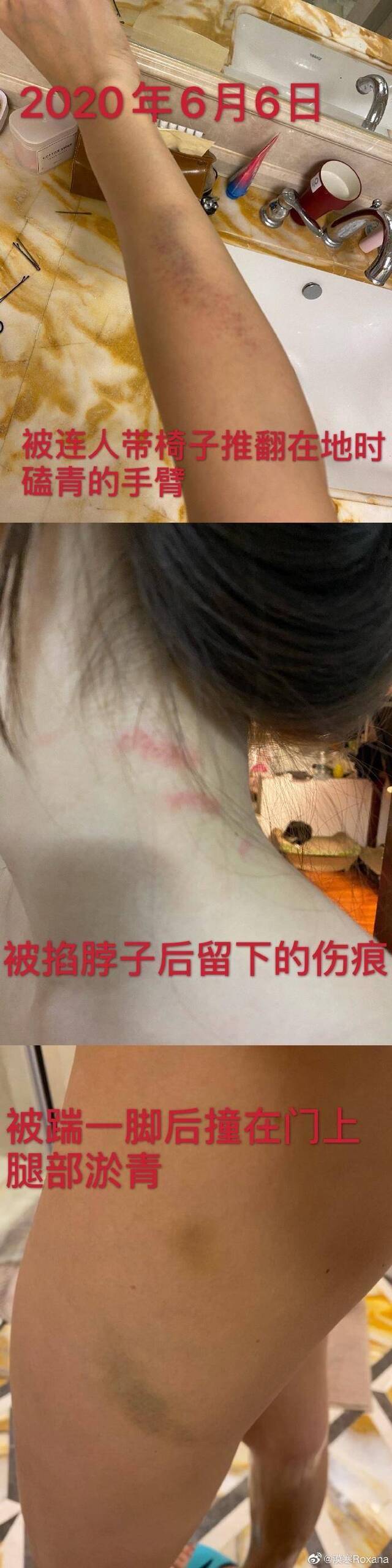 短跑名将张培萌妻子：曾在丈夫手机发现过限制级视频