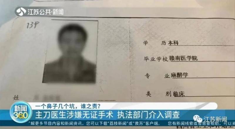 女子整形完鼻子变4个洞 医院：抽烟导致鼻子感染