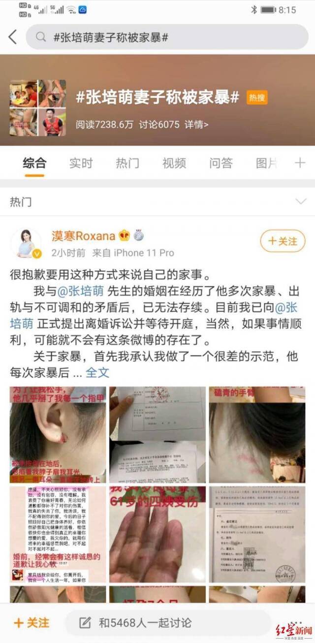 妻子曝短跑名将张培萌家暴及出轨，张培萌回应：无中生有