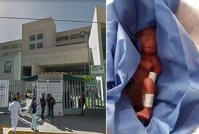 墨西哥一早产婴儿在停尸房冰箱存放6小时后被发现还活着