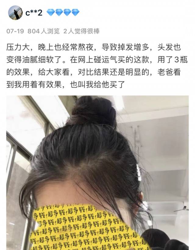 流女星们的“狮子头”都是假象？录节目竟然当场掉下假发片，真相竟然是……