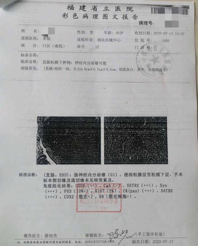 福建省立医院出具的关于陈浩的病理报告诊断：“肠神经内分泌瘤（G1），浸润粘膜层至粘膜下层”。本文图片均来自澎湃新闻记者王选辉