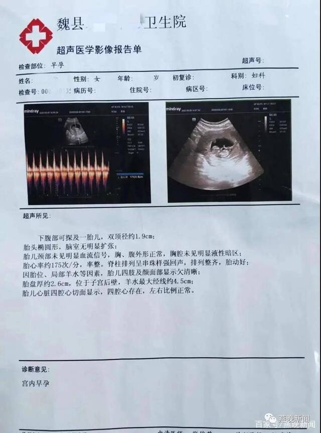 高某检查报告显示其已怀孕图据燕晚新闻