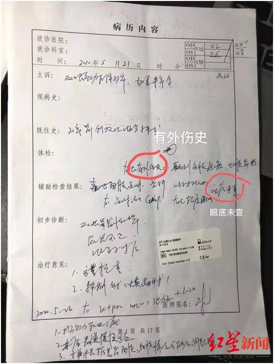 3000亿市值爱尔眼科陷医疗事故风波：急诊医生术后视网膜脱落右眼失明