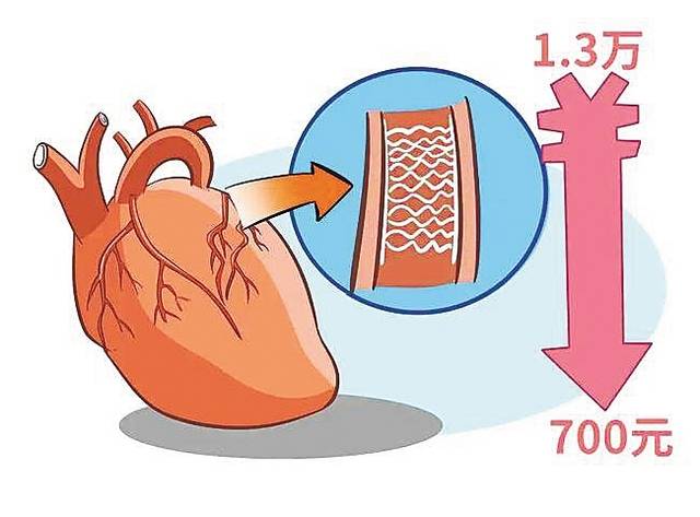 从均价1.3万元降至700元 冠脉支架集中带量采购落地海南
