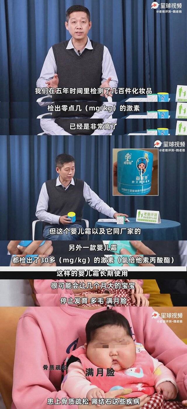 婴儿使用“益芙灵抑菌霜”两个月后成大头娃娃，图源：老爸评测