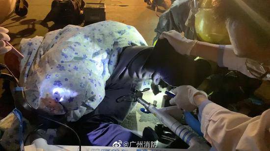 疼疼疼！男子骑共享单车，屁股被铁架刺穿…