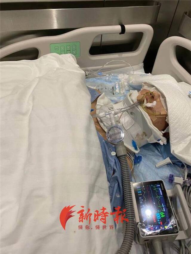 实习司机驾驶共享汽车把大学生撞进ICU，天价医药费该谁赔付