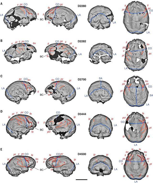 瑞士苏黎世大学研究揭示早期人类的大脑结构