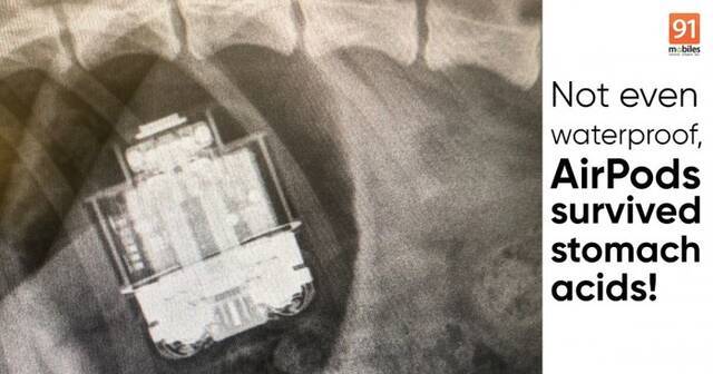 通过手术从狗的胃里取出的AirPods继续工作