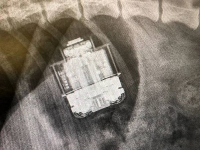通过手术从狗的胃里取出的AirPods继续工作