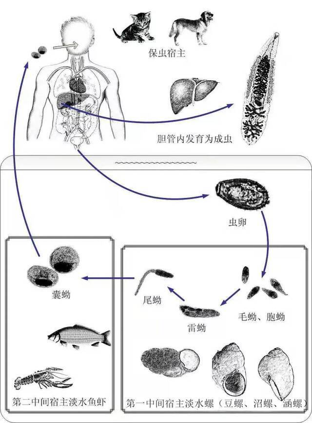 21岁女子突发腹痛高热，紧急住院，竟因两个月前吃了这个东西？