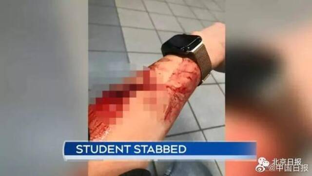 中国留学生手臂被歹徒持刀刺伤，鲜血直流