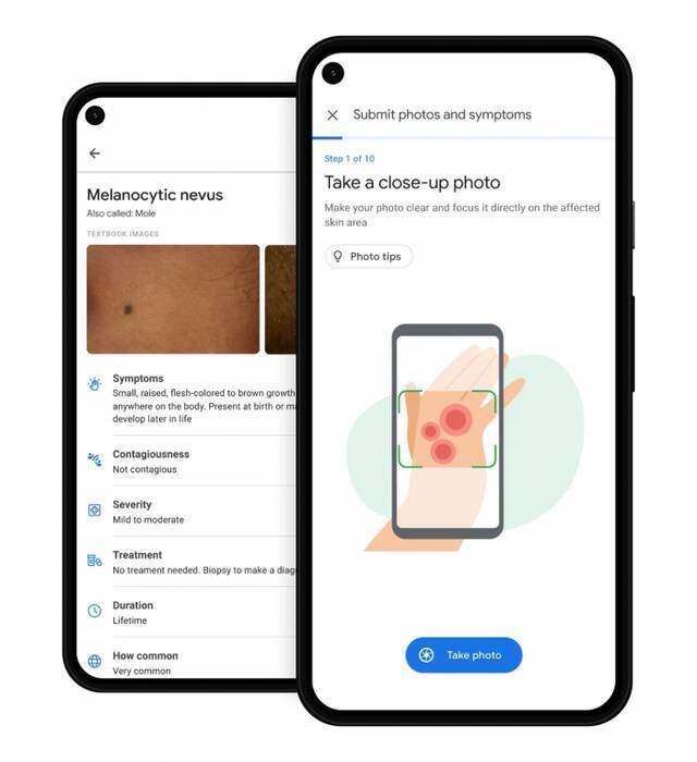 谷歌发布用于识别皮肤状况的健康工具