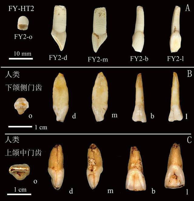 孙雪峰等在福岩洞发现的牙齿同人类牙齿对比.（A）引自Sun et al. 2021；（B）道县2012年发现的人类下颌侧门齿；（C）黄龙洞2006发现的人类上