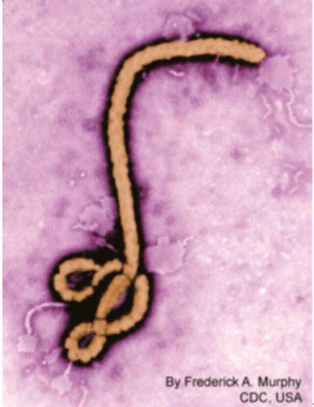 德堡“病毒暗史”：埃博拉病毒全球之旅及泄漏之虞带来的启示