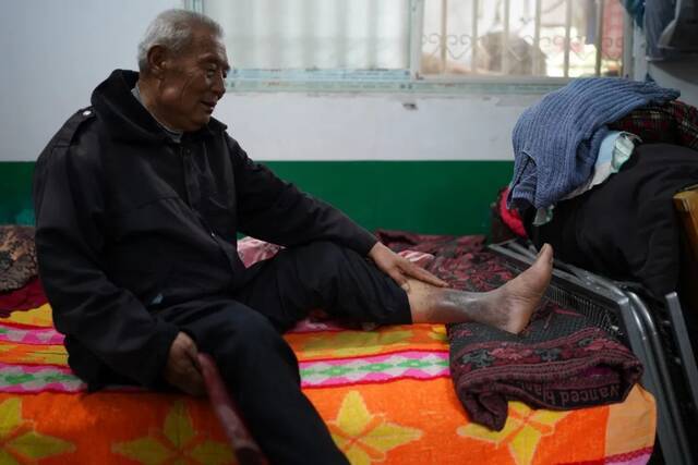 5月15日，唐金顺在陶岔工地受伤的腿部，脚踝处有20厘米左右逐渐发黑。新京报记者刘旻摄