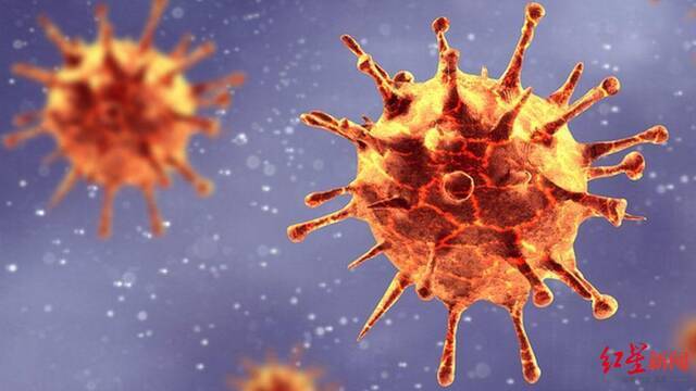 ▲新冠病毒在一名HIV患者体内发生了32次突变，其中包括13次关键的刺突蛋白突变。图据BBC新闻