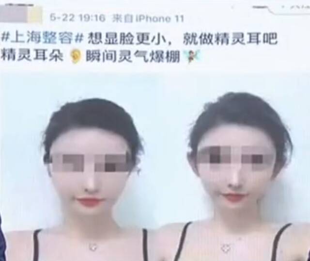 多家整形机构推“精灵耳”变美？专家：或整成畸形