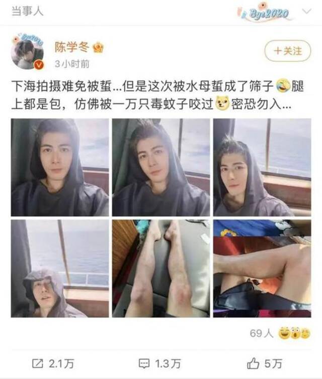 知名男星被水母蛰，医生提醒：游泳时千万别碰它，严重可能丧命！